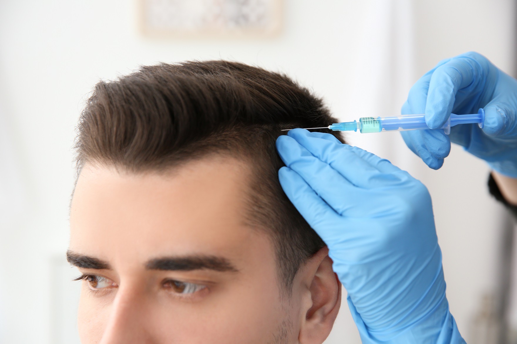 Platelet Rich Plasma Therapy For Hair Loss