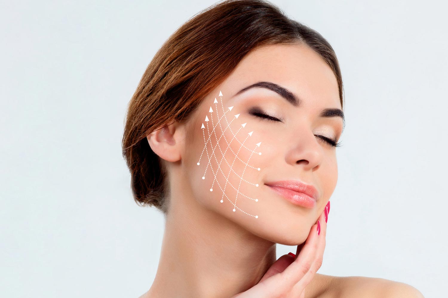 Thread Lift Benefits: Lifting, Tightening, and Natural Contours