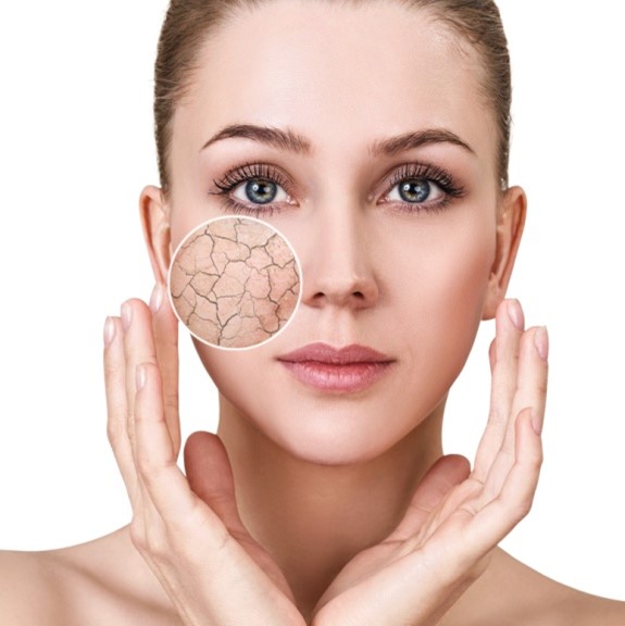 Understanding the Skin Barrier