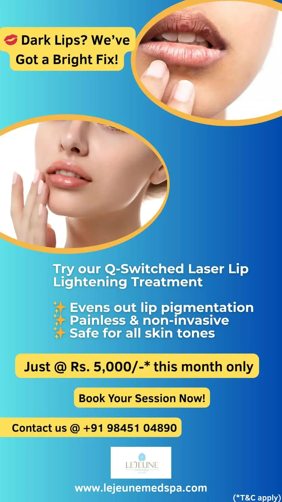 Dull or Dark Lips? We’ve Got the Glow-Up You Need!