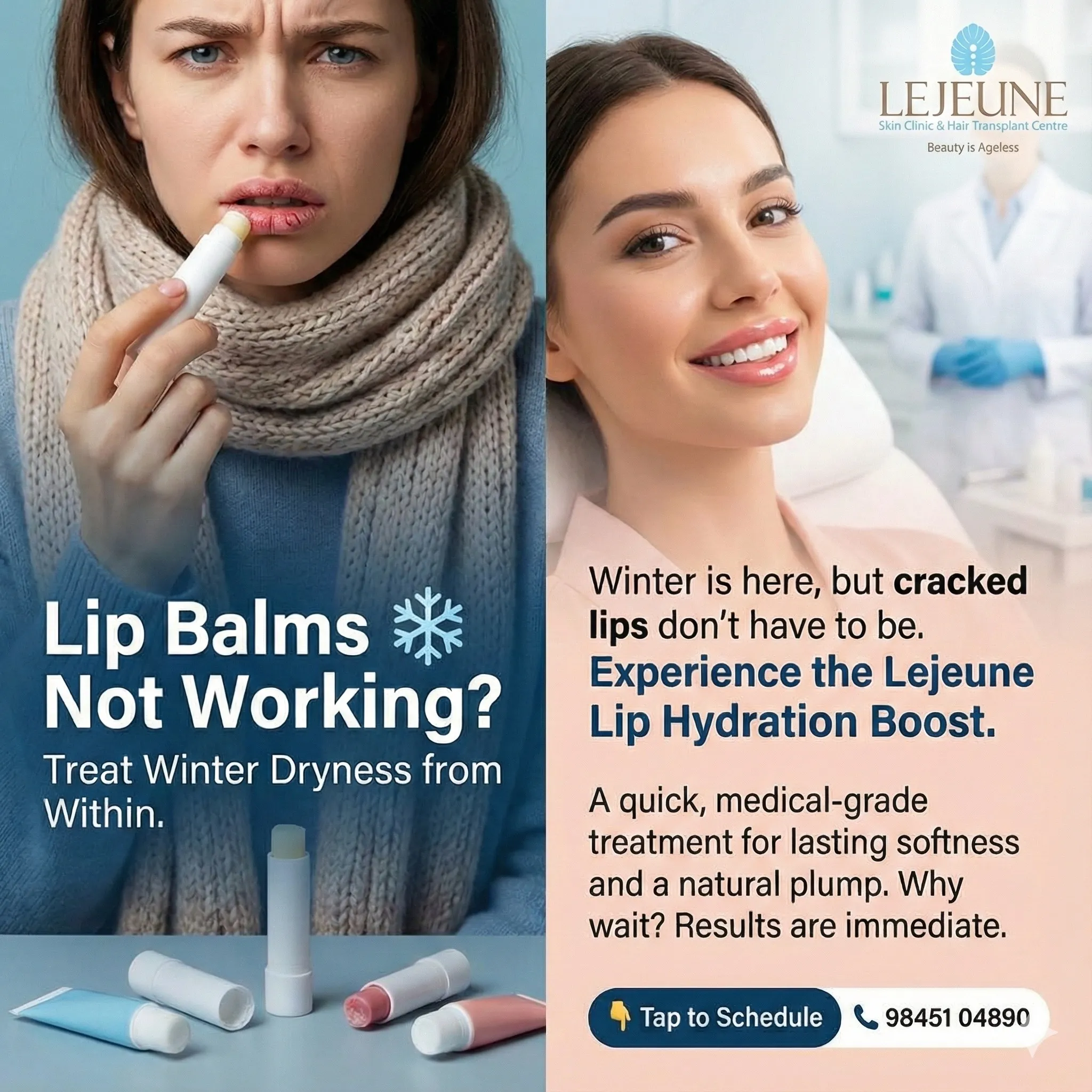 Why Your Lips Crack in Winter & Treatments That Actually Work