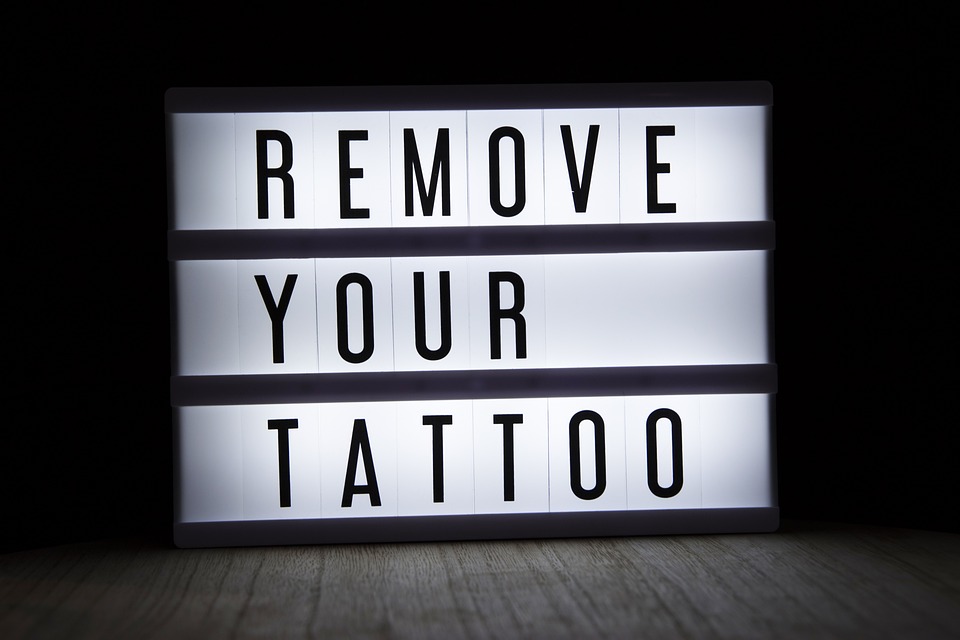 Tattoo_Removal