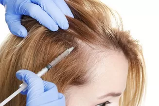 PRP for Hair Growth
